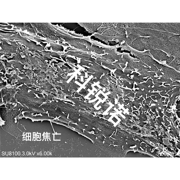 细胞焦亡